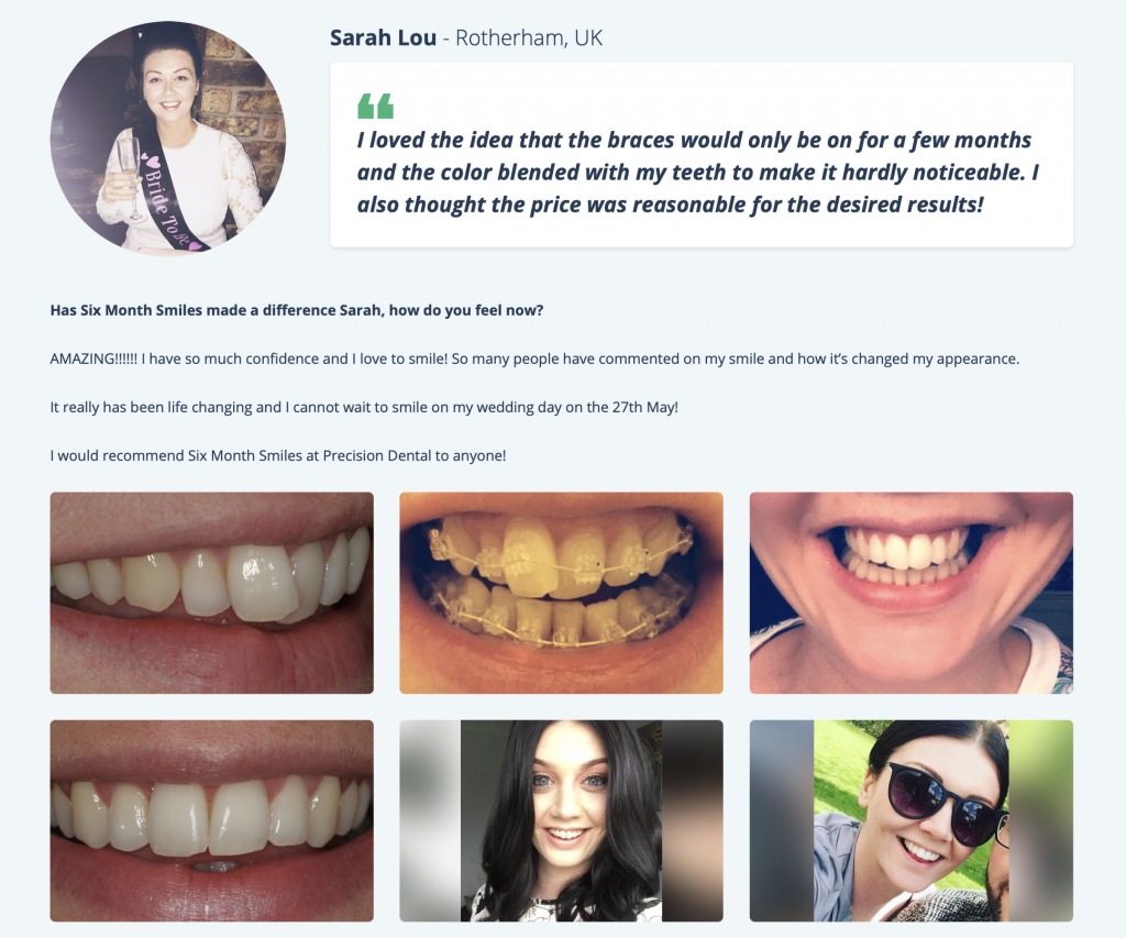 Wild Rose Family Dentistry 6 Month Smile Sarah