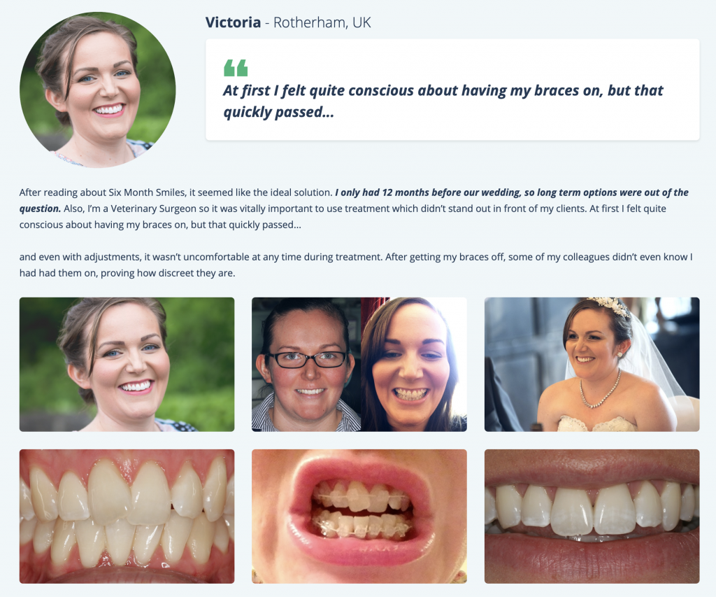Wild Rose Family Dentistry 6 Month Smile Victoria