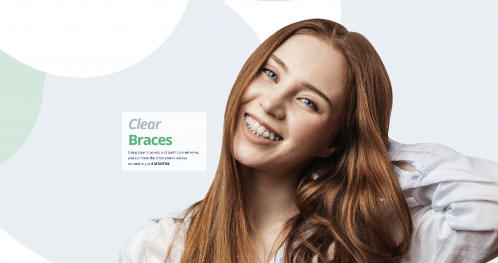 Wild Rose Family Dentistry Clear Braces